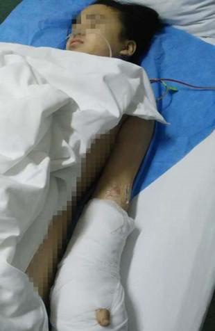 12岁女孩上学路上被砍断三根手指